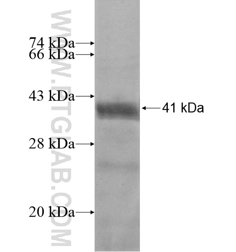 ZNF559 fusion protein Ag15005 SDS-PAGE