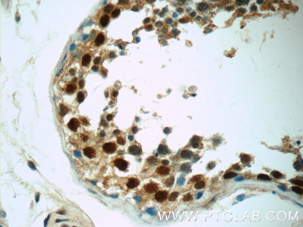 IHC staining of human testis using 25302-1-AP