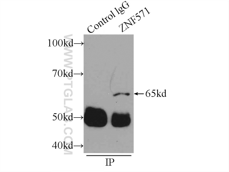 IP experiment of MCF-7 using 25302-1-AP