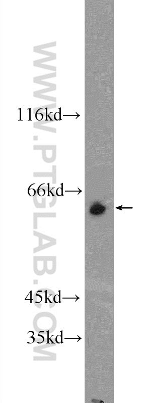 WB analysis of MCF-7 using 25302-1-AP