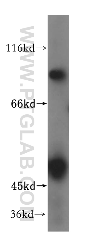 WB analysis of HEK-293 using 17249-1-AP