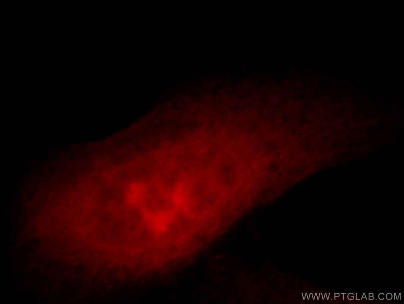 IF Staining of HeLa using 20804-1-AP