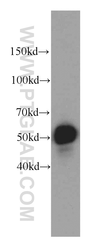 WB analysis of HeLa using 20804-1-AP