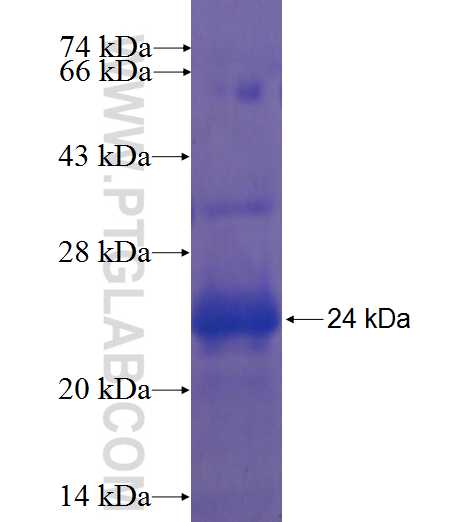 ZNF623 fusion protein Ag22540 SDS-PAGE