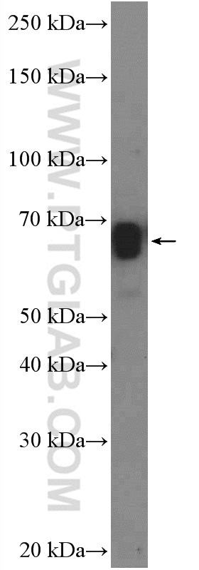 WB analysis of HeLa using 25817-1-AP