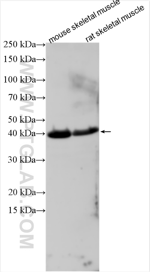 ZNF641