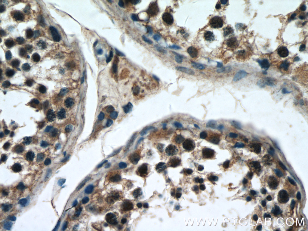 IHC staining of human testis using 24823-1-AP