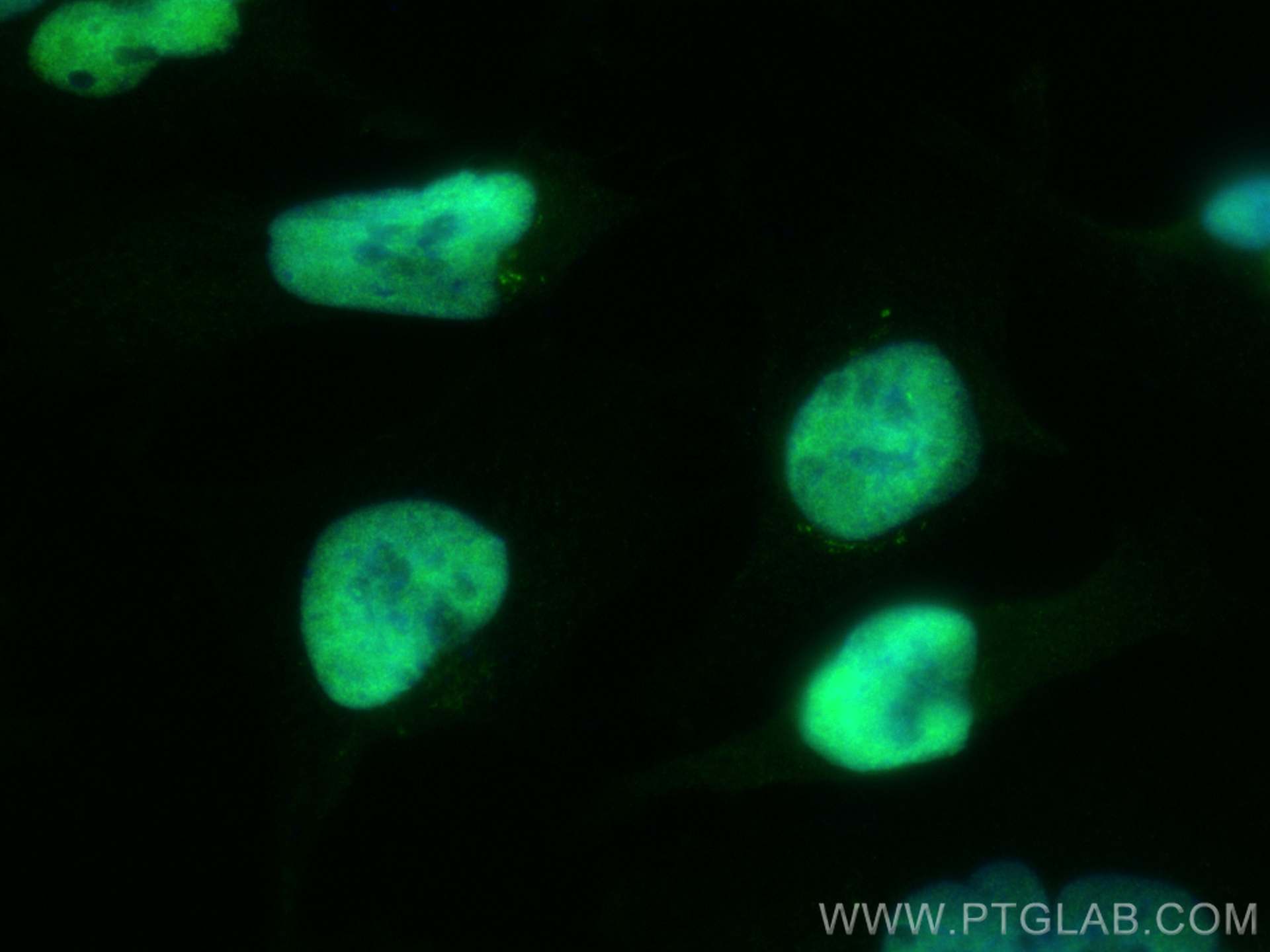 IF Staining of U-251 using 21329-1-AP