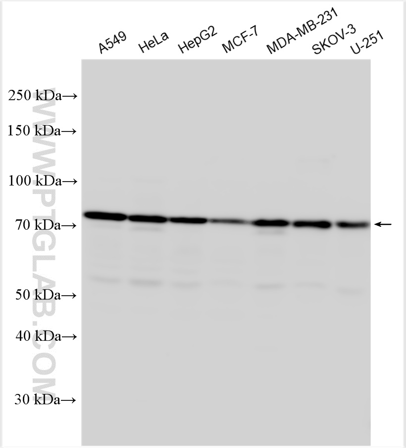 WB analysis using 21329-1-AP