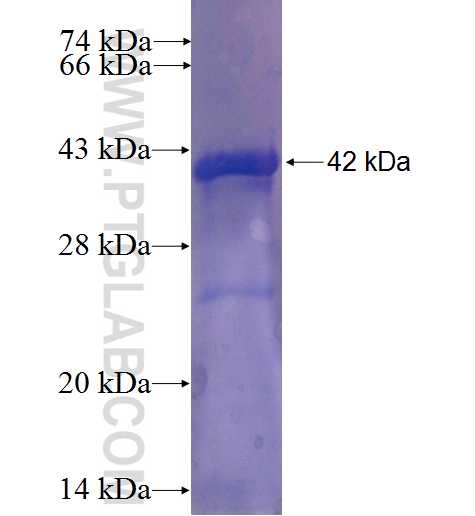 ZNF672 fusion protein Ag22886 SDS-PAGE