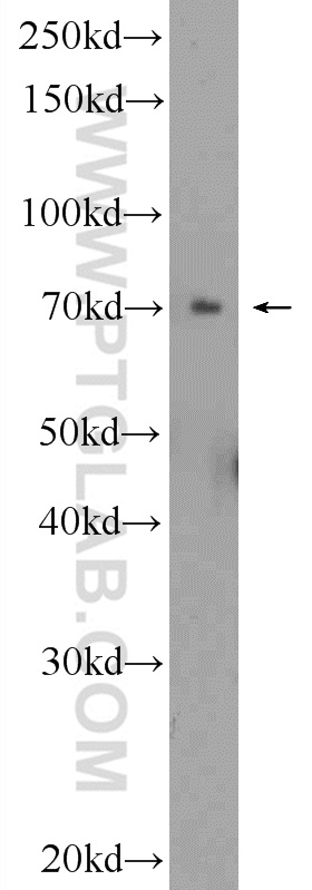 WB analysis of HepG2 using 25556-1-AP