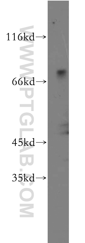 WB analysis of human brain using 21562-1-AP