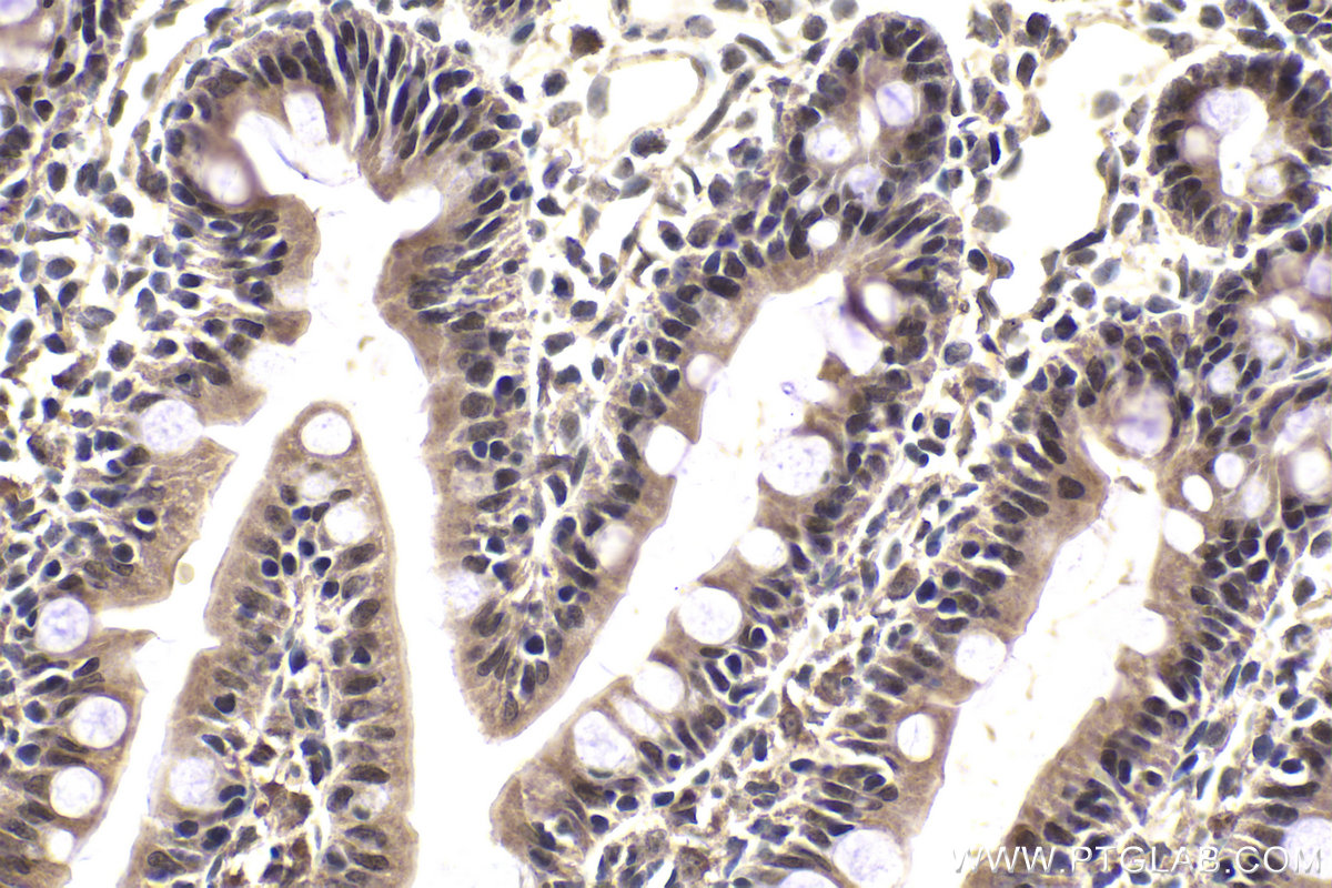 IHC staining of rat small intestine using 21075-1-AP