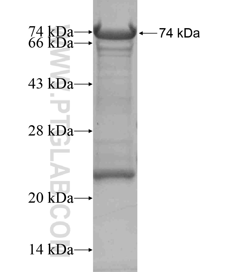 ZNF711 fusion protein Ag18309 SDS-PAGE