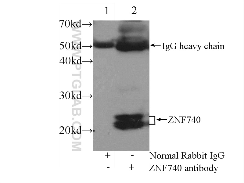 IP experiment of mouse brain using 25411-1-AP