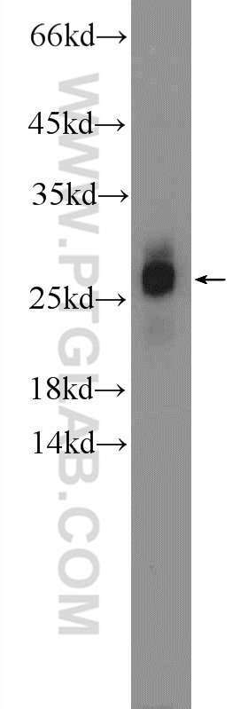 WB analysis of mouse brain using 25411-1-AP