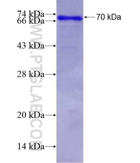 ZNF746 fusion protein Ag21566 SDS-PAGE