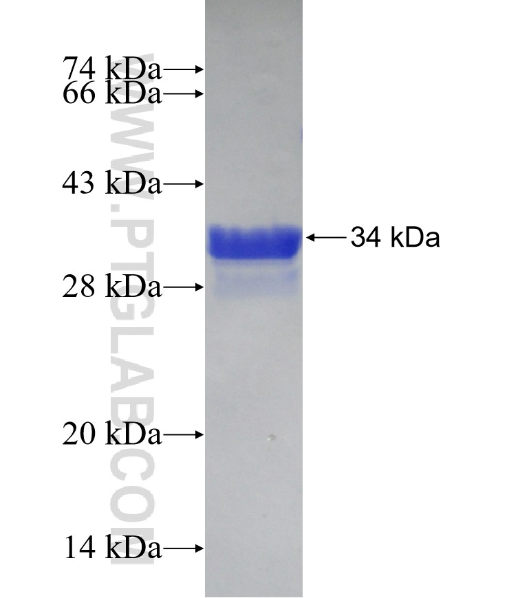 ZNF75D fusion protein Ag16139 SDS-PAGE