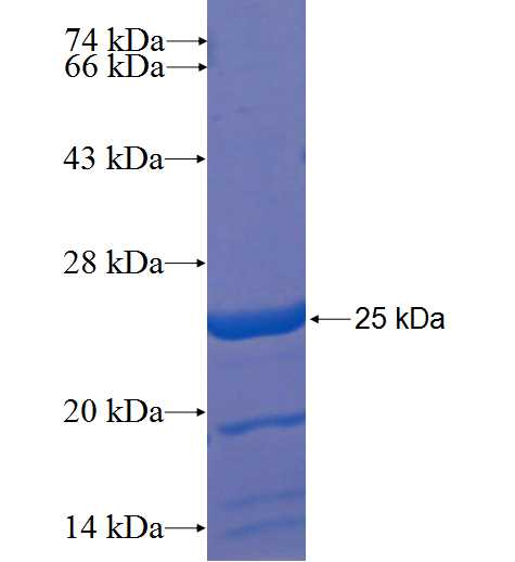 ZNF774 fusion protein Ag22370 SDS-PAGE