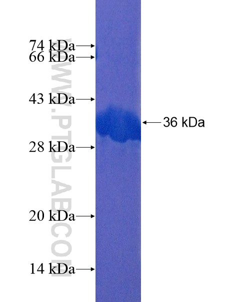 ZNF783 fusion protein Ag21744 SDS-PAGE