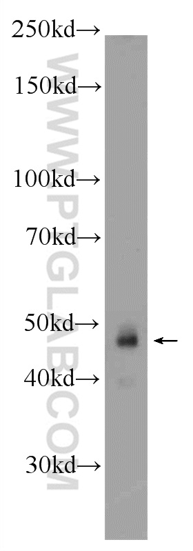 WB analysis of HeLa using 25588-1-AP