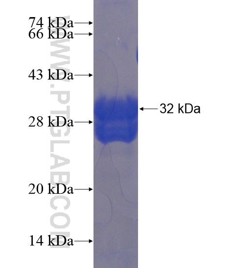 ZNF785 fusion protein Ag22291 SDS-PAGE