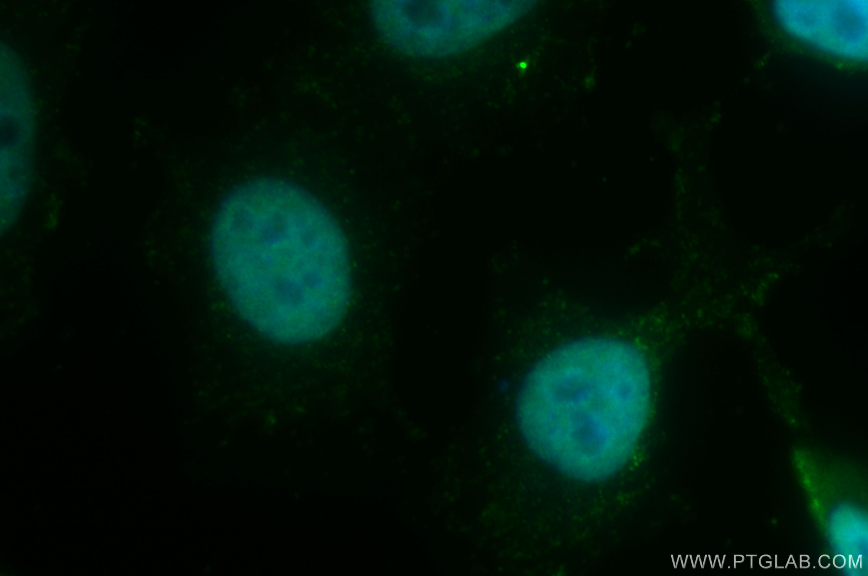 IF Staining of HeLa using 26315-1-AP