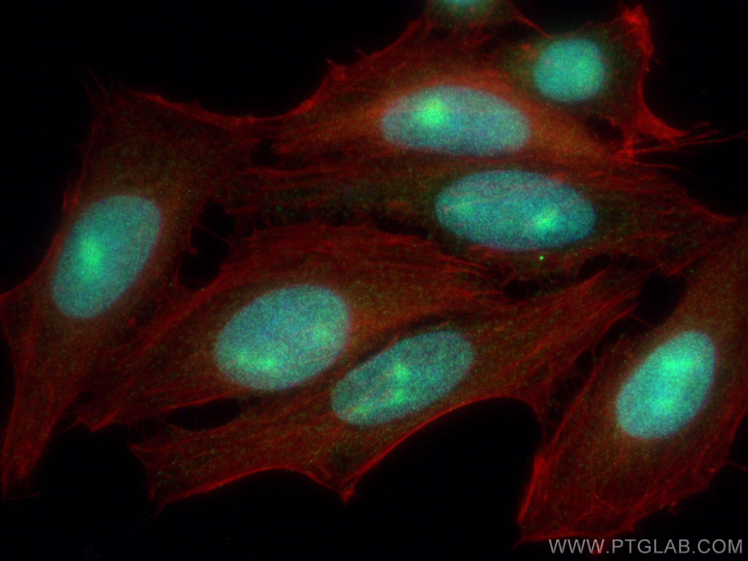 IF Staining of HepG2 using 16595-1-AP