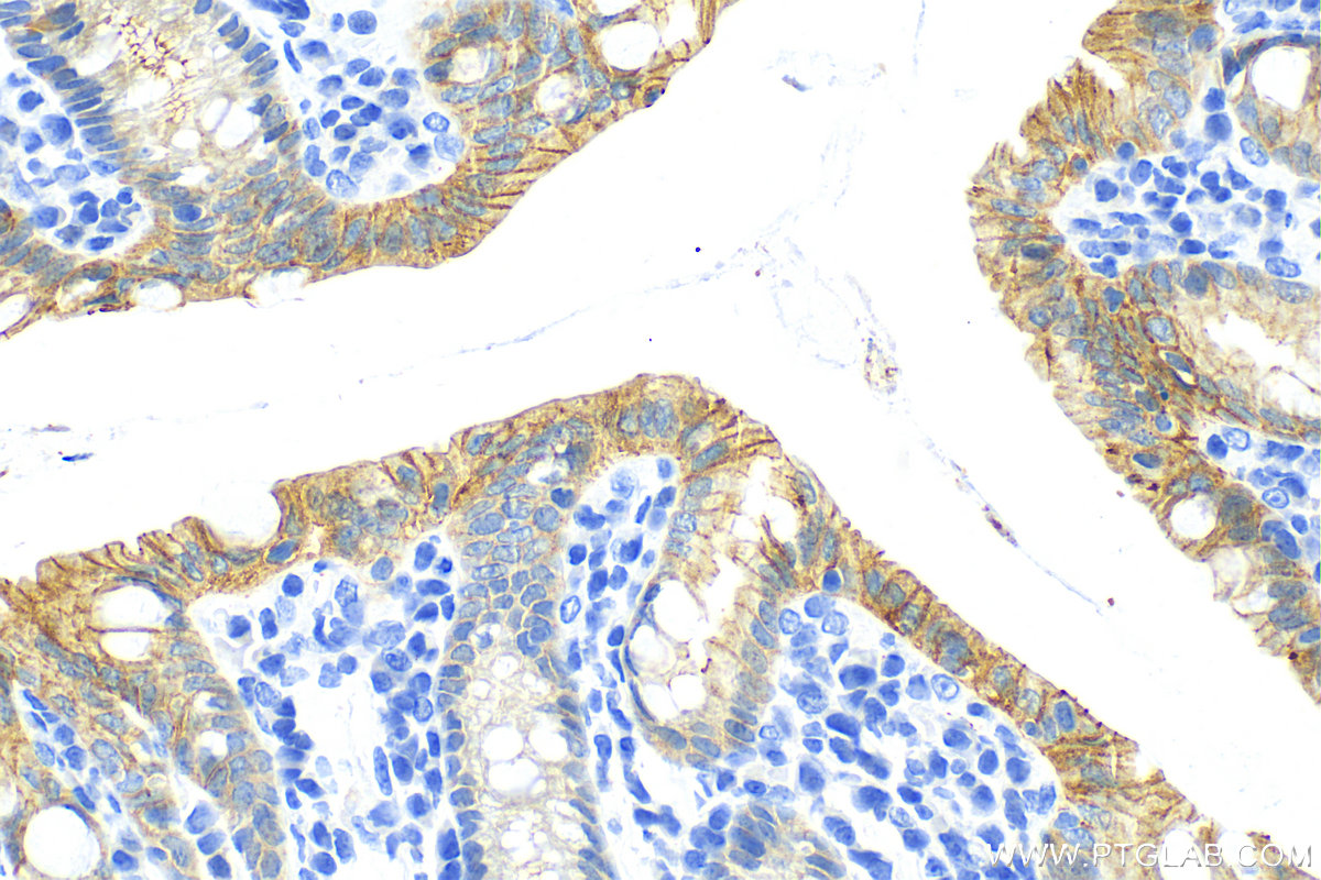 IHC staining of mouse colon using 83111-1-RR (same clone as 83111-1-PBS)