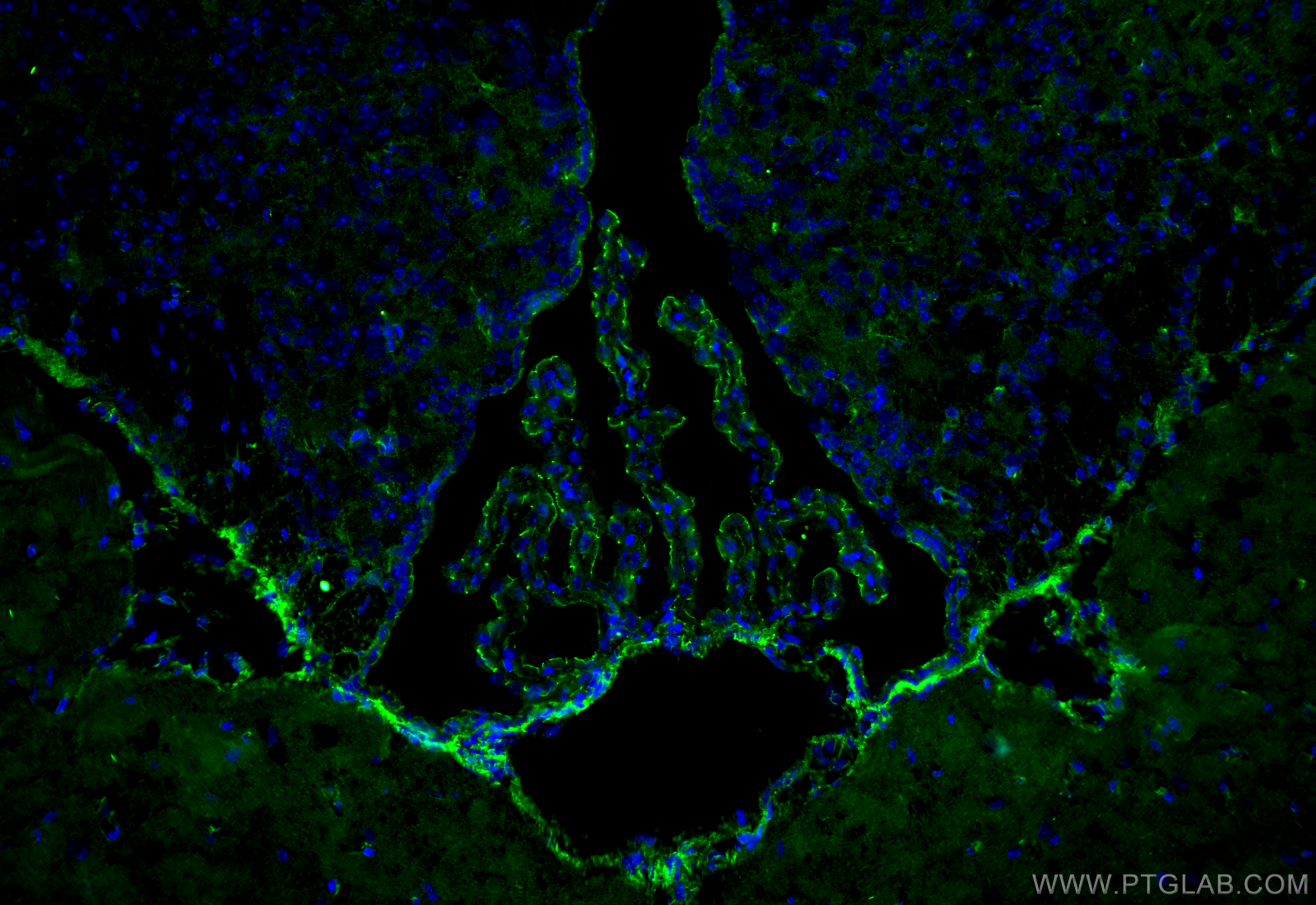 IF Staining of mouse brain using 21773-1-AP