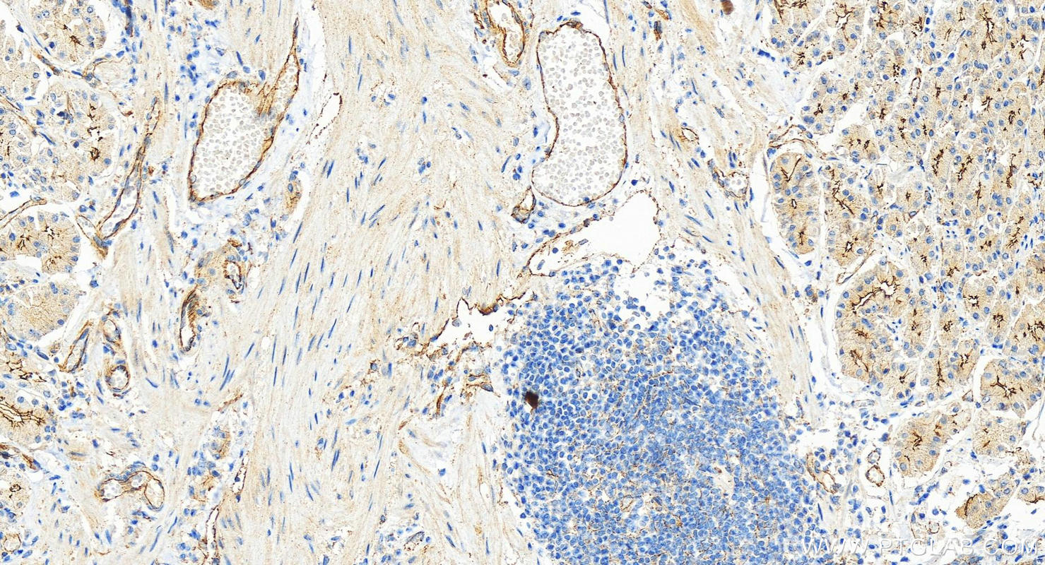 IHC staining of human stomach using 30487-1-AP