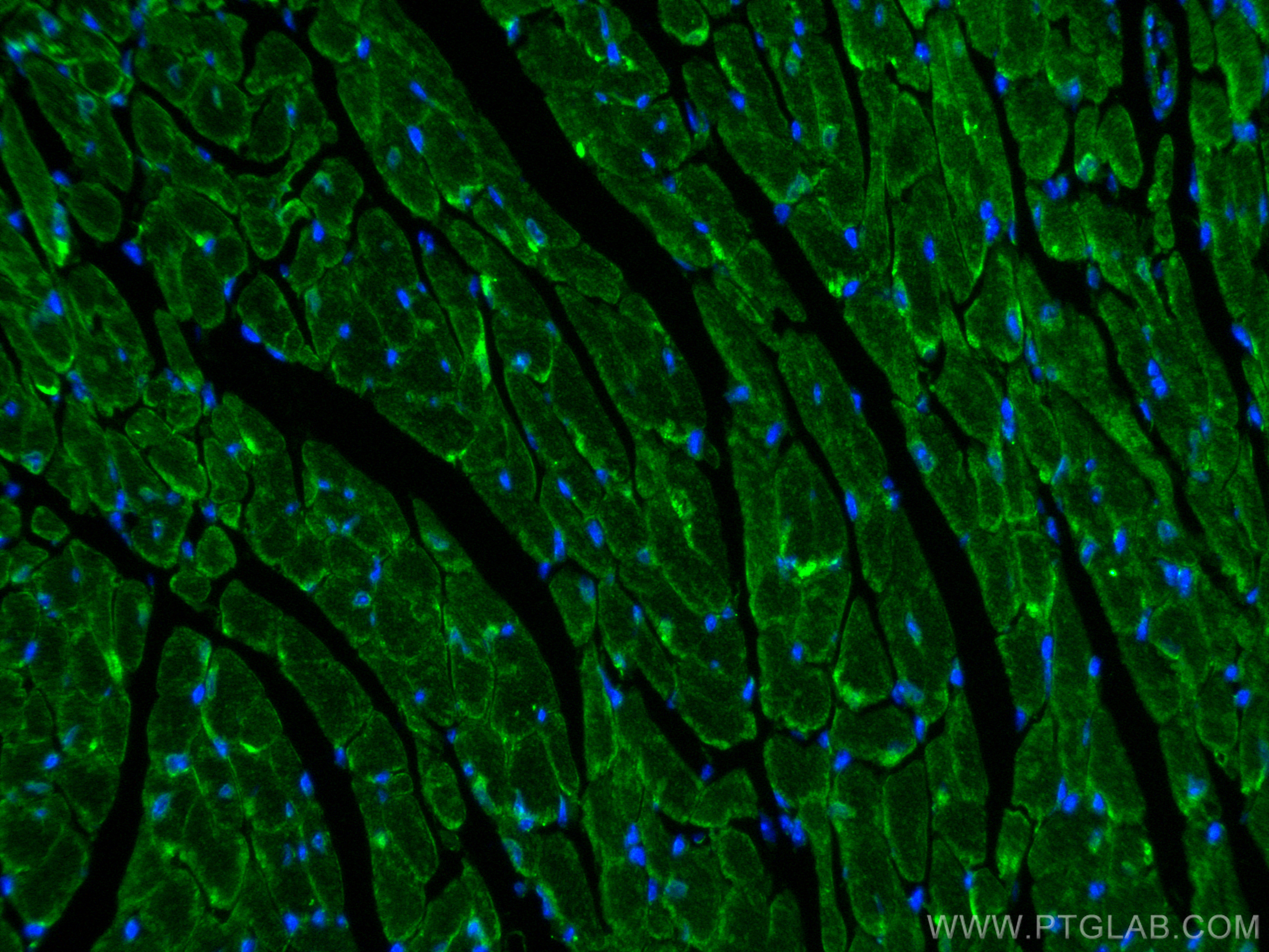 IF Staining of mouse heart using 30487-1-AP