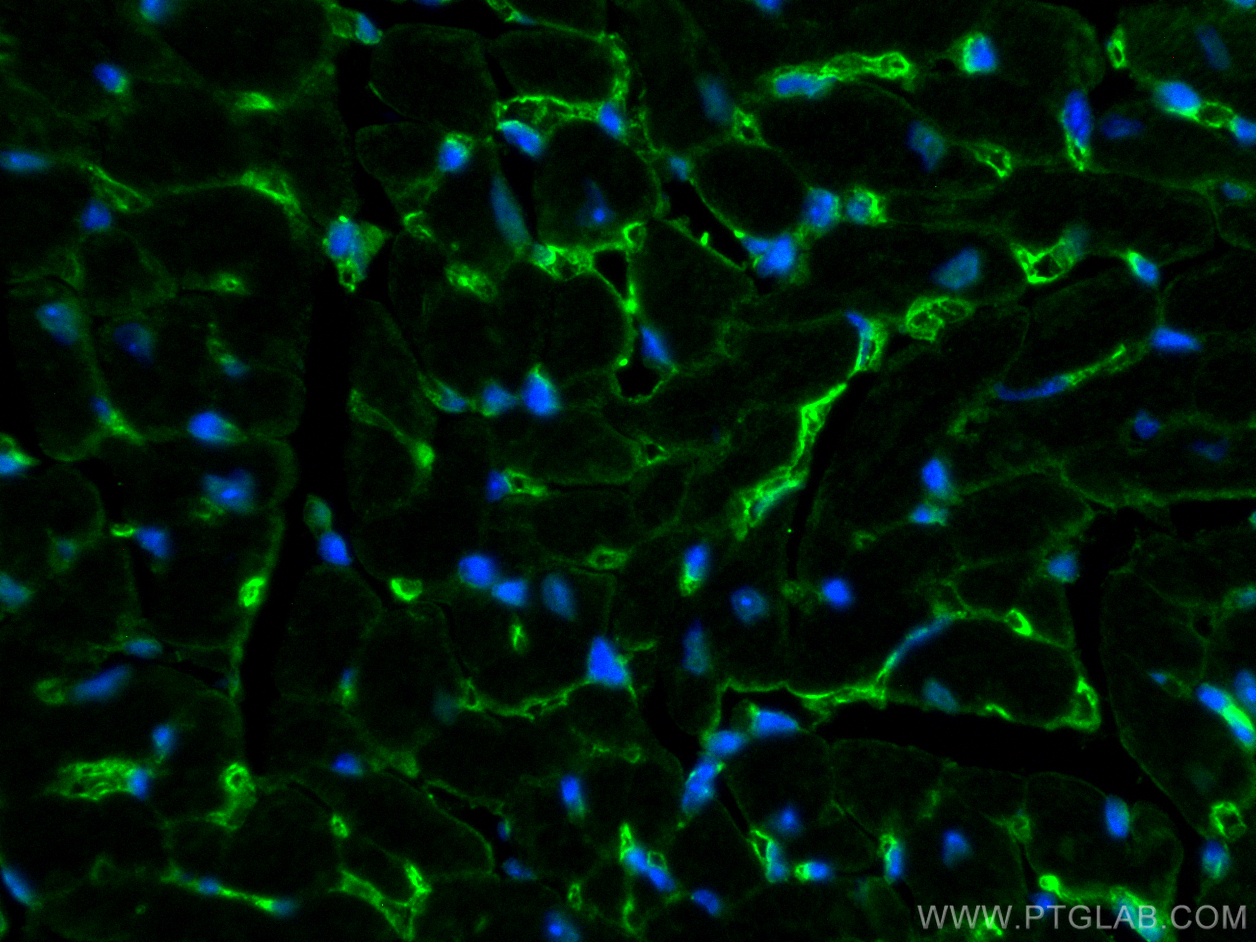 IF Staining of mouse heart using 30487-1-AP