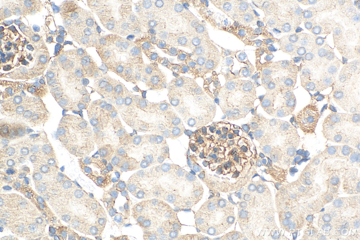 IHC staining of mouse kidney using 82870-1-RR (same clone as 82870-1-PBS)