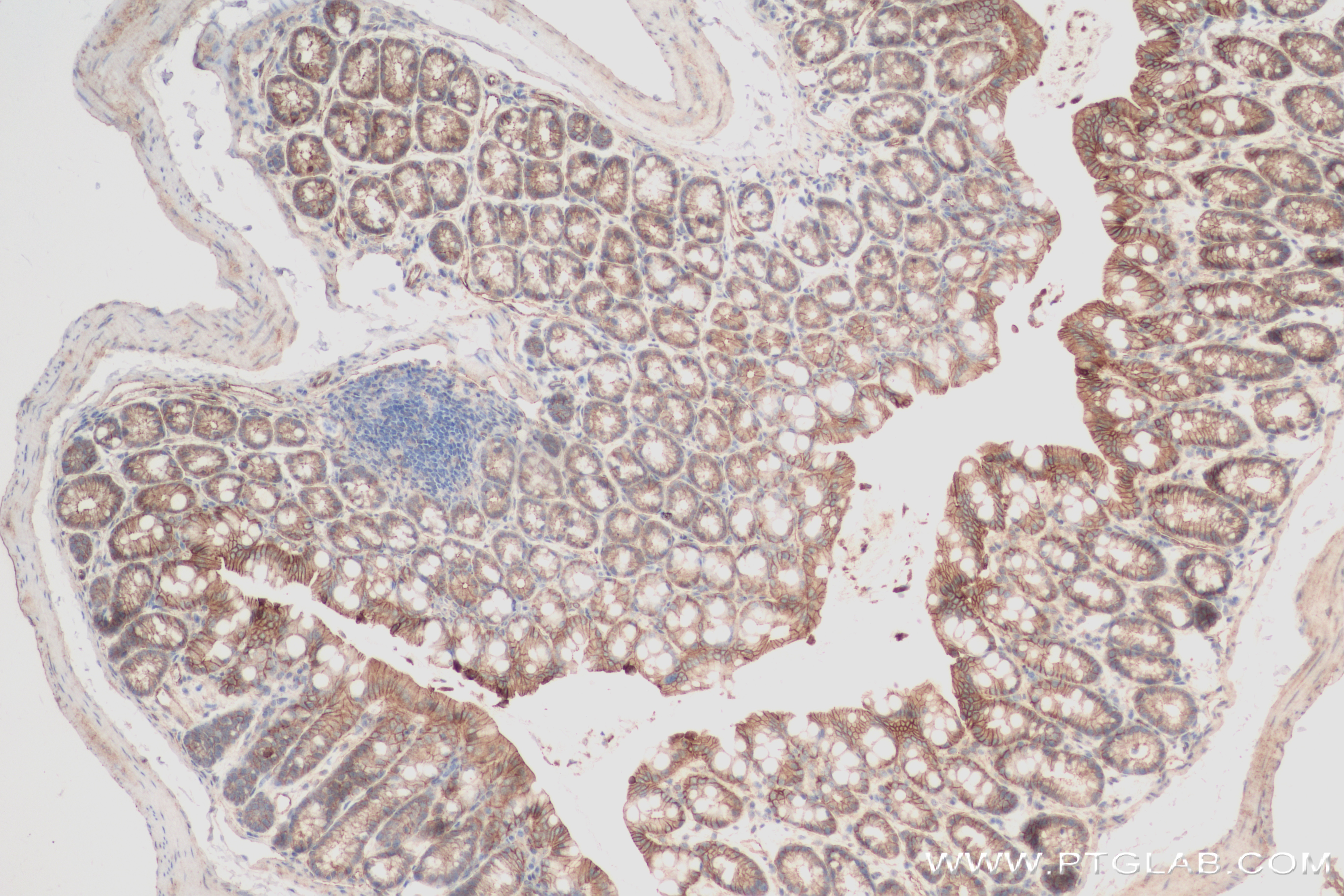 IHC staining of mouse colon using 82870-1-RR (same clone as 82870-1-PBS)