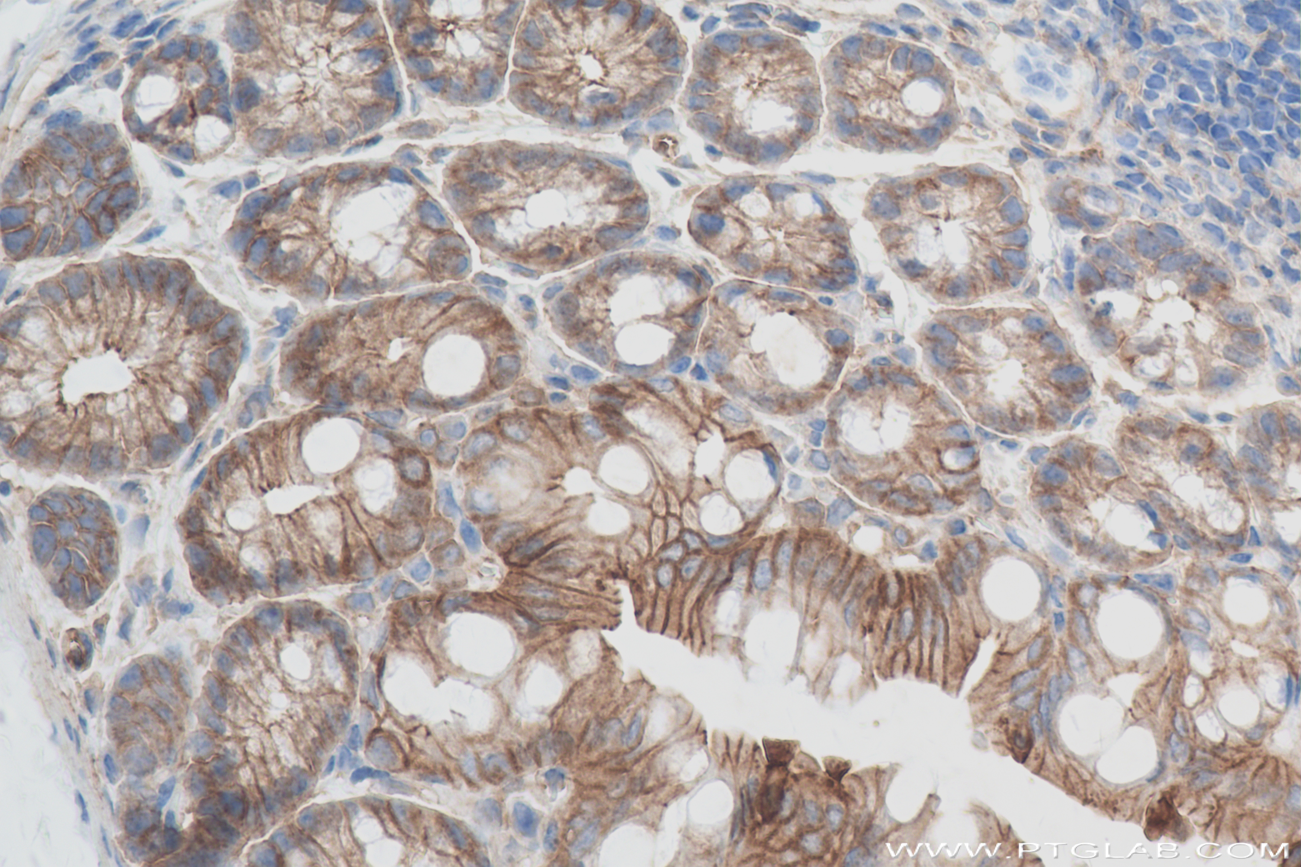 IHC staining of mouse colon using 82870-1-RR (same clone as 82870-1-PBS)