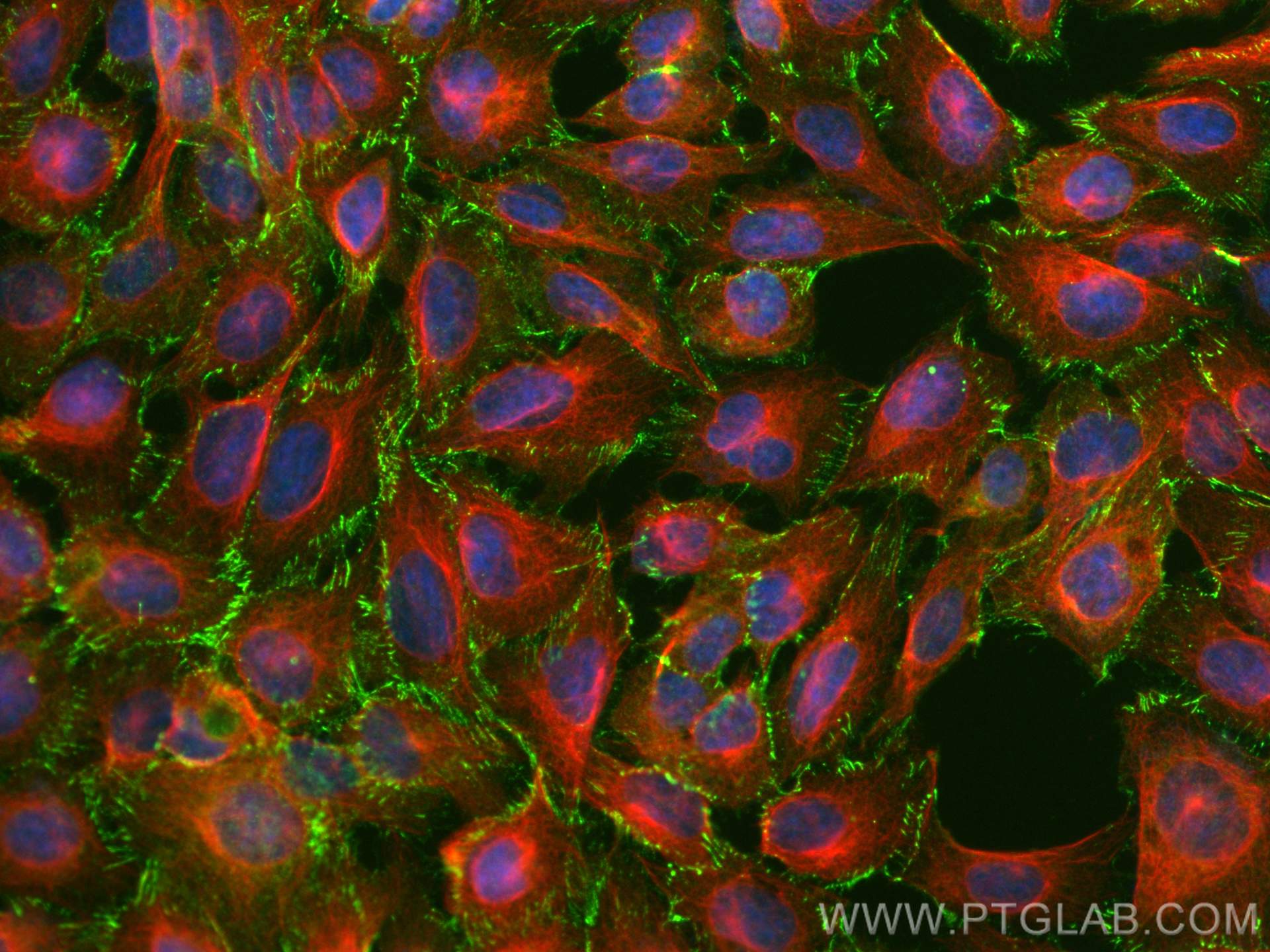 IF Staining of U2OS using 82870-7-RR