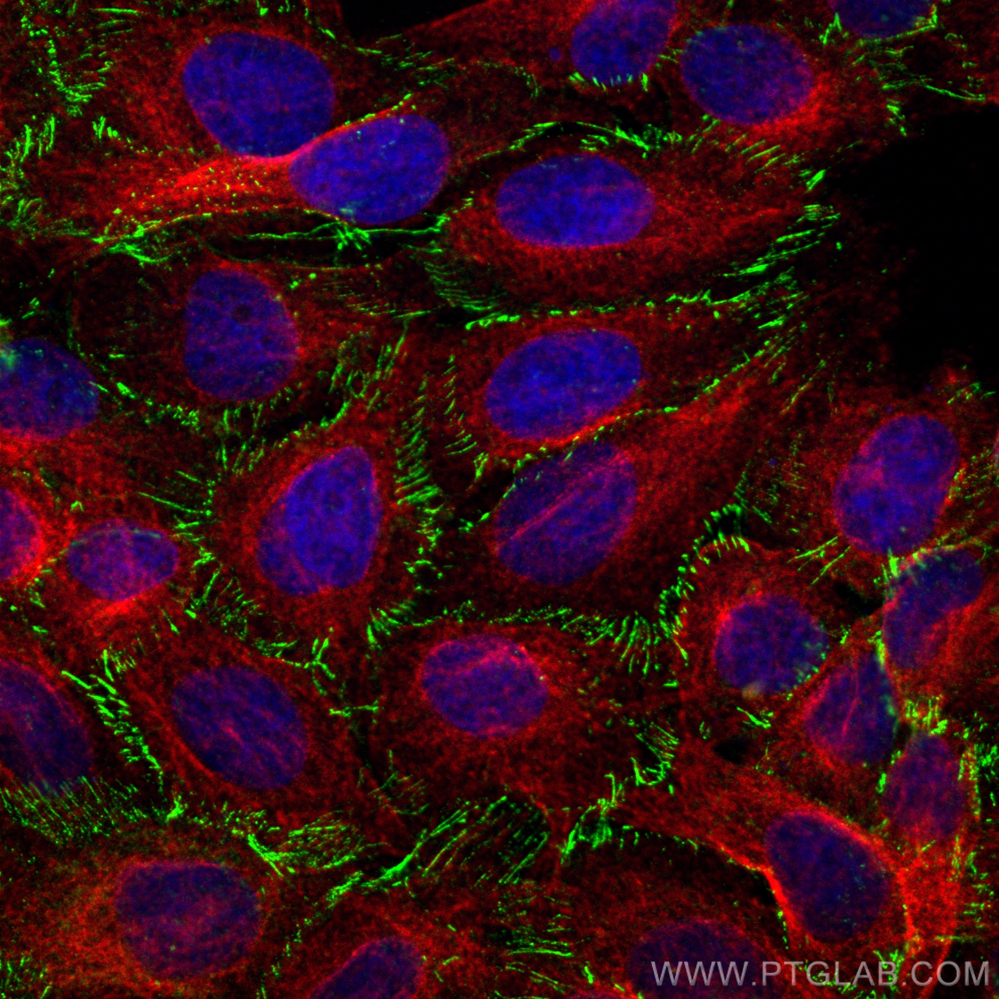 IF Staining of U2OS using 82870-7-RR