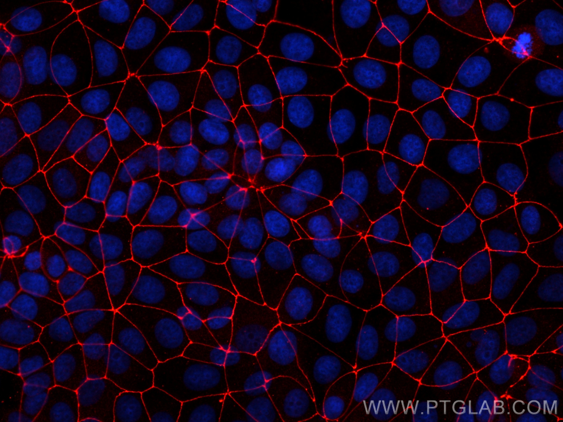 IF Staining of MCF-7 using 82870-7-RR