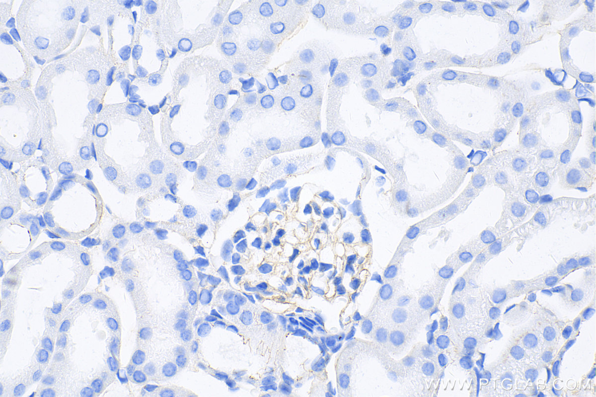 IHC staining of mouse kidney using 82870-7-RR