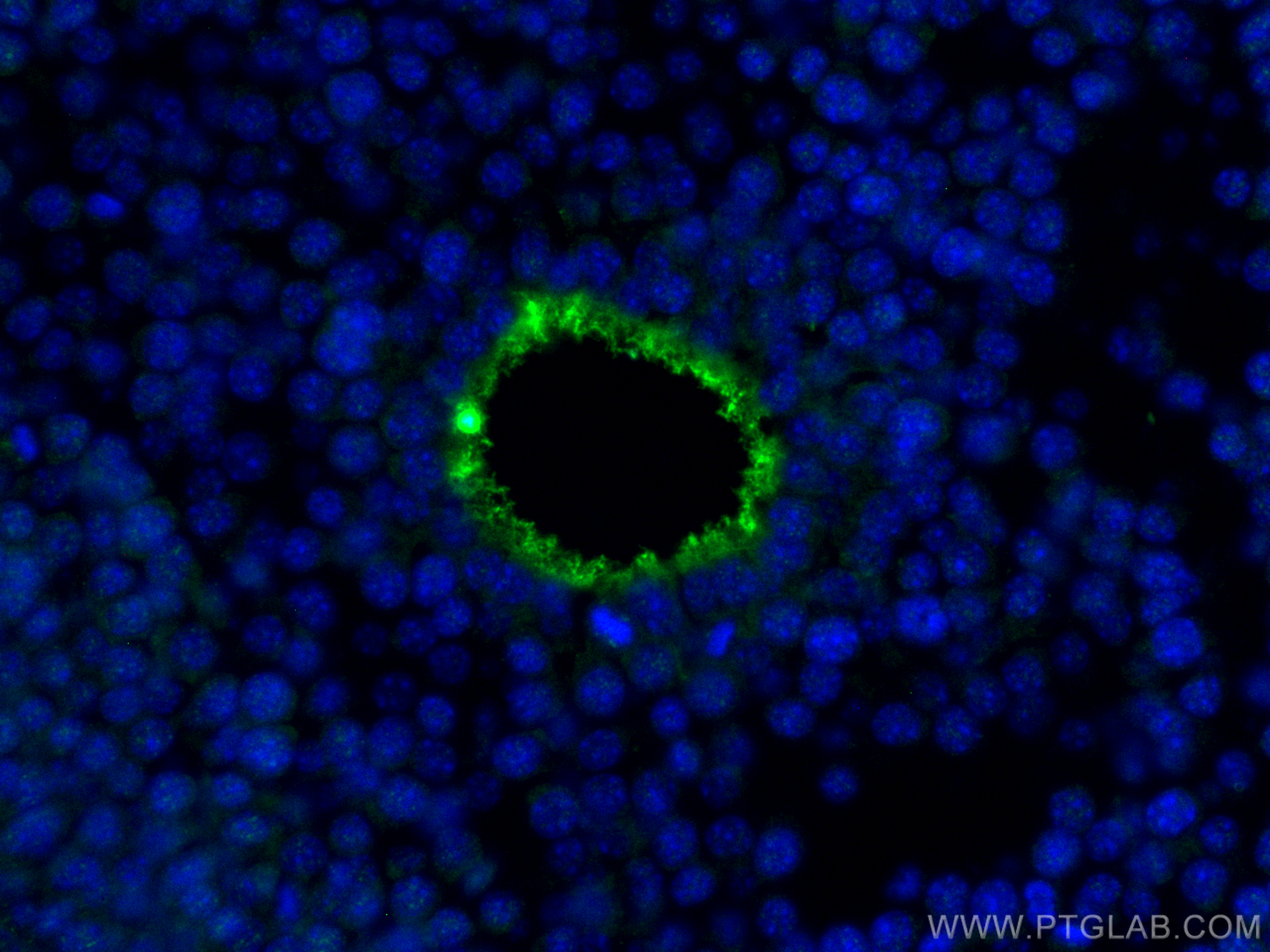 IF Staining of mouse ovary using 21832-1-AP