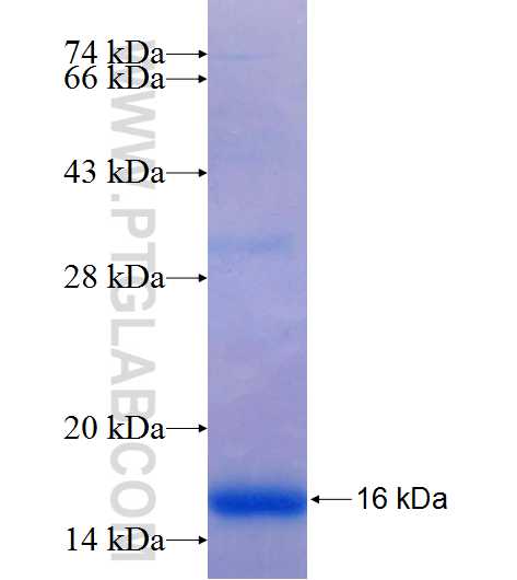 ZRANB1 fusion protein Ag25798 SDS-PAGE