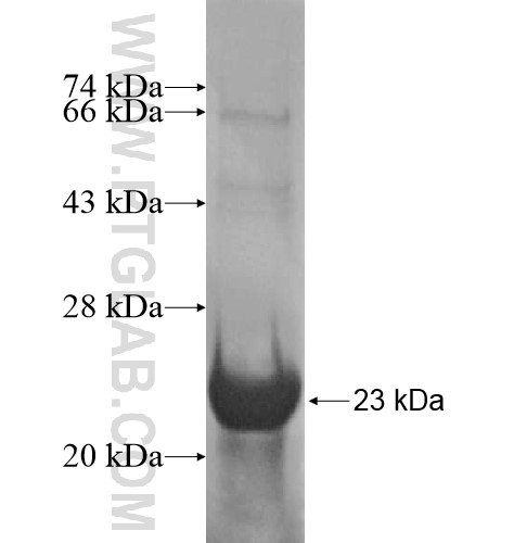 ZSCAN16 fusion protein Ag14992 SDS-PAGE