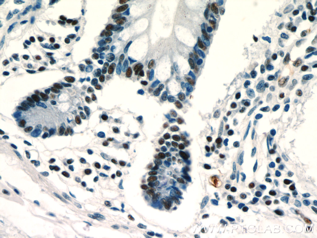 IHC staining of human small intestine using 20855-1-AP