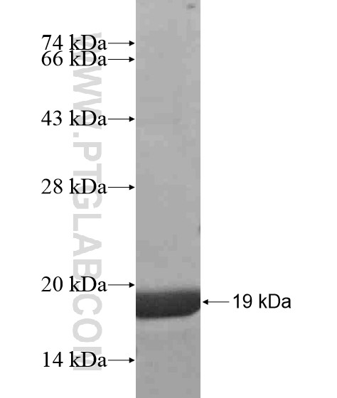 ZSCAN23 fusion protein Ag20250 SDS-PAGE