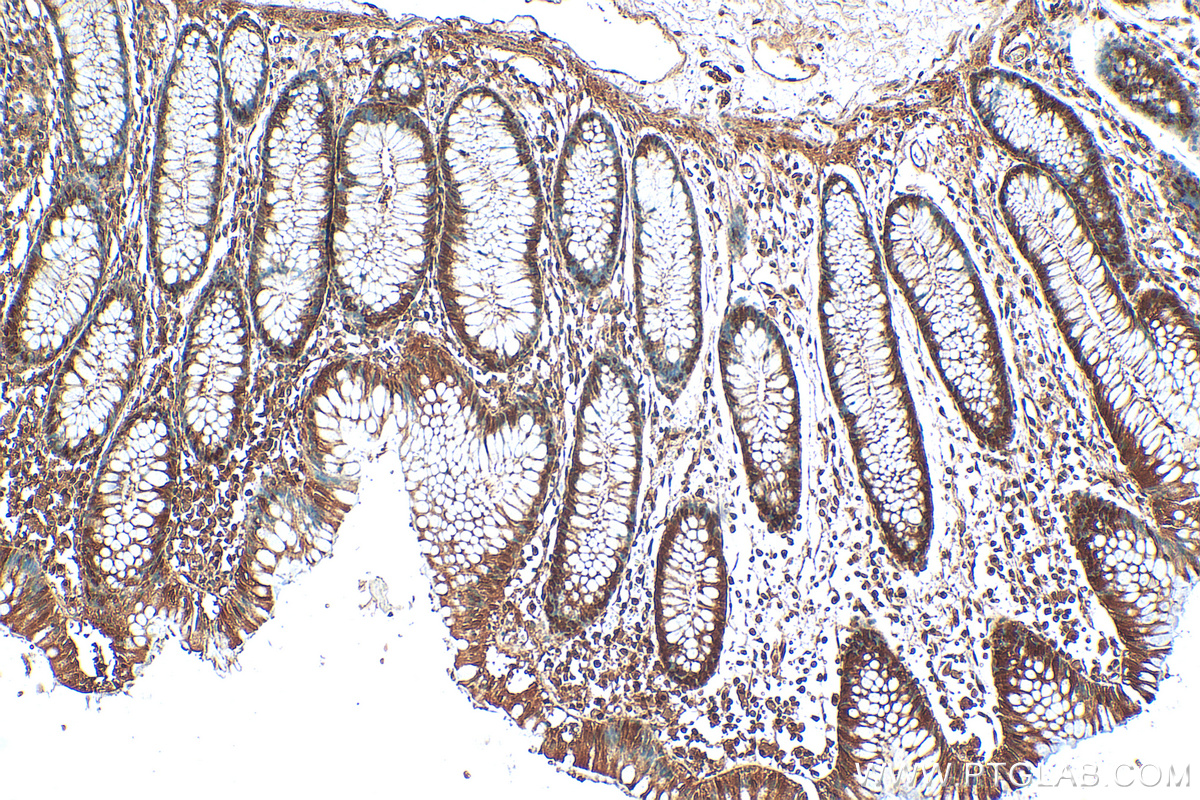 IHC staining of human colon using 21630-1-AP