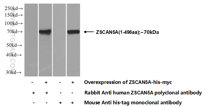 ZSCAN5A