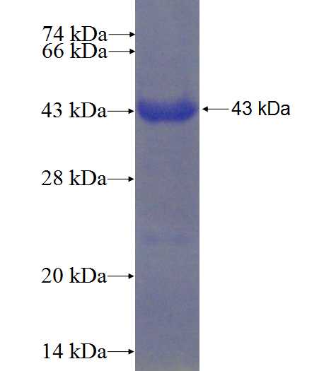 ZSWIM3 fusion protein Ag22380 SDS-PAGE