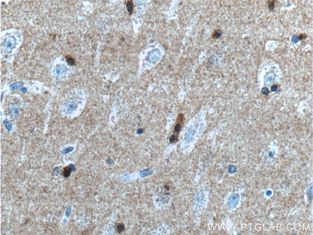 IHC staining of human brain using 66412-1-Ig