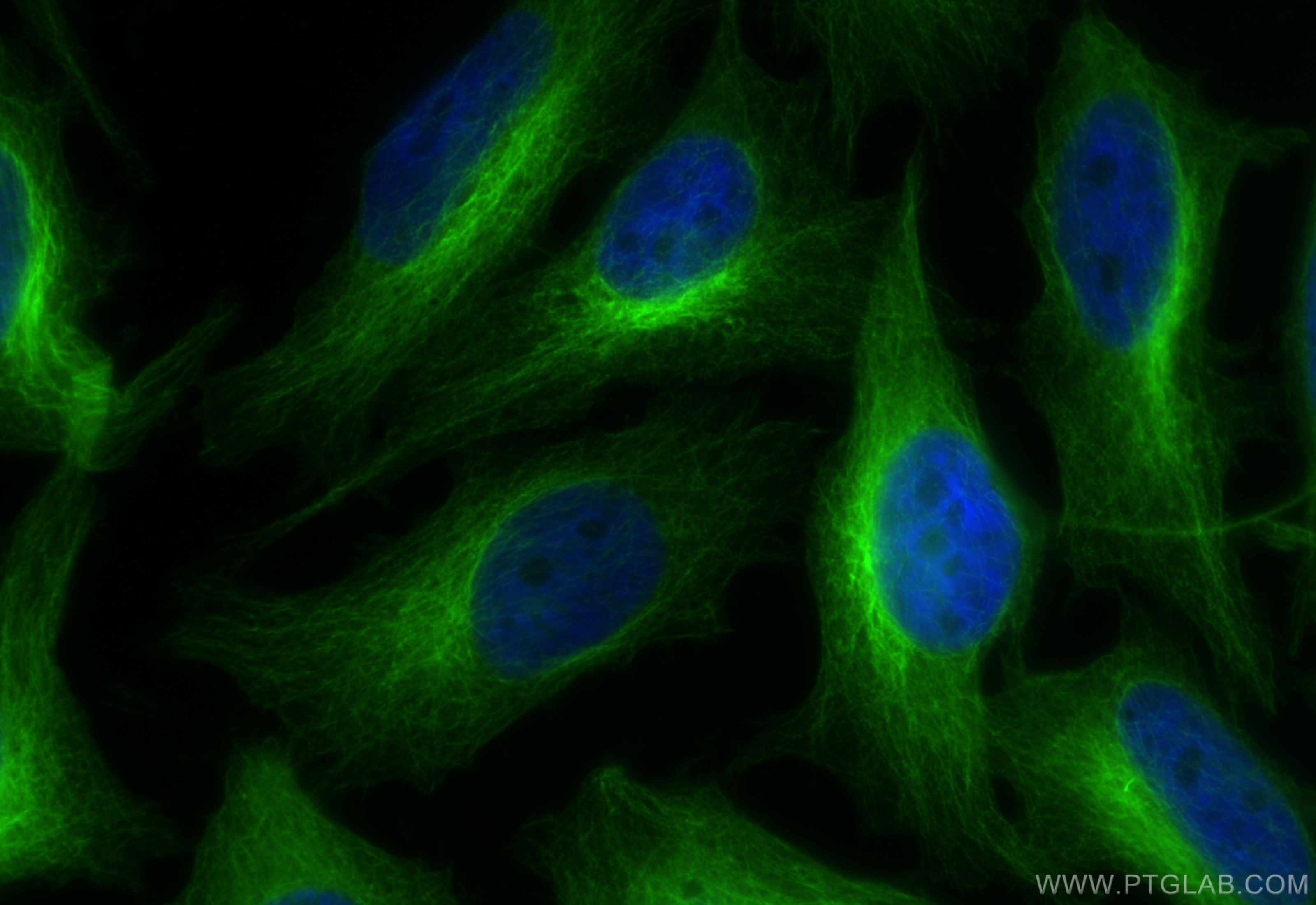 IF Staining of HeLa using CL488-66031